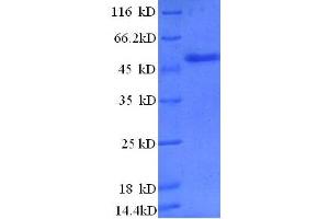 SDS-PAGE (SDS) image for Zinc Finger, BED-Type Containing 1 (ZBED1) (AA 1-210), (partial) protein (GST tag) (ABIN7479603) (ZBED1 Protein (AA 1-210, partial) (GST tag))