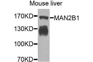 Western blot analysis of extracts of mouse liver, using MAN2B1 antibody (ABIN6003645) at 1/1000 dilution. (MAN2B1 antibody)