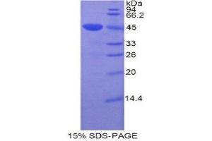 SDS-PAGE (SDS) image for Cerebral Dopamine Neurotrophic Factor (CDNF) (AA 33-187) protein (His tag,GST tag) (ABIN2122599)