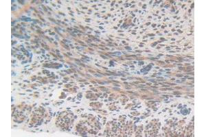 IHC-P analysis of Mouse Uterus Tissue, with DAB staining. (CS antibody  (AA 174-428))