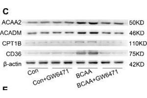BCAA upregulate PPAR-α and PPAR-α targeted genes. (Medium-Chain Specific Acyl-CoA Dehydrogenase, Mitochondrial (MCAD) (AA 1-220) antibody)