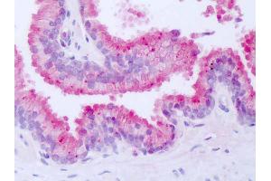 Immunohistochemistry (IHC) image for anti-Nuclear Receptor Subfamily 1, Group D, Member 1 (NR1D1) (Internal Region) antibody (ABIN1049130)