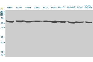 EPOR monoclonal antibody (M01), clone 3D10. (EPOR antibody  (AA 31-130))