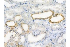 ABIN7096366 and ABIN7100429 at 1/100 staining human normal kidney tissue by IHC-P.