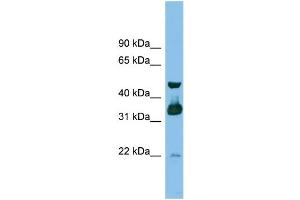 WB Suggested Anti-GBL Antibody Titration: 0. (GBL antibody  (Middle Region))