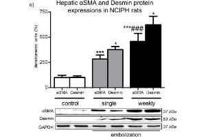 Western Blotting (WB) image for anti-Desmin (DES) antibody (ABIN2855655)