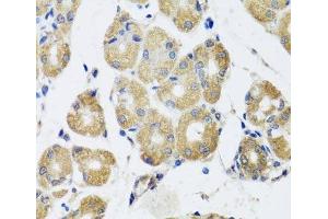 Immunohistochemistry of paraffin-embedded Human stomach using RAD51C Polyclonal Antibody at dilution of 1:100 (40x lens). (RAD51C antibody)