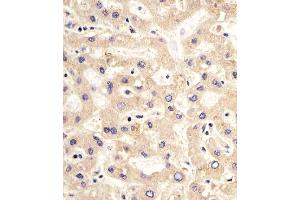 Paraformaldehyde-fixed, paraffin embedded Human Liver tissue, Antigen retrieval by boiling in sodium citrate buffer (pH6. (PDK2 antibody)