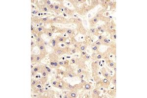 Paraformaldehyde-fixed, paraffin embedded Human Liver tissue, Antigen retrieval by boiling in sodium citrate buffer (pH6. (PDK2 antibody)