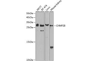 Western blot analysis of extracts of various cell lines, using CHMP2B antibody (ABIN6131571, ABIN6138545, ABIN6138547 and ABIN6217398) at 1:1000 dilution. (CHMP2B antibody  (AA 1-213))