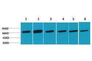 Western Blotting (WB) image for anti-Heat Shock 70kDa Protein 8 (HSPA8) antibody (ABIN3179025) (Hsc70 antibody)