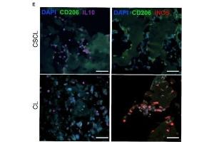 Characterization of infiltrating cells at day 1 post implant. (IL-10 antibody  (AA 101-178))