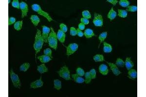 IF analysis of ROCK2 using anti-ROCK2 antibody (ABIN7602236). (ROCK2 antibody  (AA 652-909))