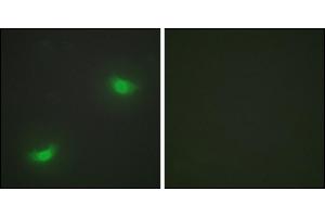 Immunofluorescence analysis of HepG2 cells, using DUSP16 antibody. (DUSP16 antibody)