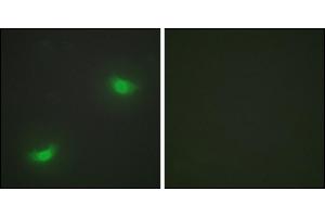 Immunofluorescence analysis of HepG2 cells, using DUSP16 antibody.