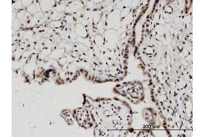 Immunoperoxidase of monoclonal antibody to H2AFV on formalin-fixed paraffin-embedded human placenta. (H2AFV antibody  (AA 1-128))