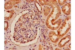 Immunohistochemistry of paraffin-embedded human kidney tissue using ABIN7151839 at dilution of 1:100 (EPH Receptor A4 antibody  (AA 345-545))