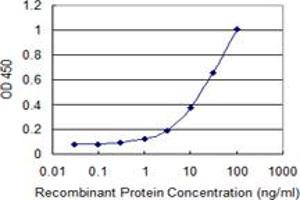 Detection limit for recombinant GST tagged KRT5 is 0. (Cytokeratin 5 antibody  (AA 1-590))