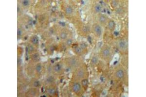 Used in DAB staining on fromalin fixed paraffin-embedded Liver tissue (MEPE antibody  (AA 212-445))