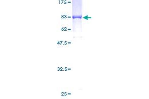 GIT2 Protein (AA 1-471) (GST tag)