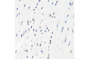 Immunohistochemistry of paraffin-embedded rat heart using MonoMethyl-Histone H3-R8 antibody (ABIN3017482, ABIN3017483, ABIN3017484 and ABIN6220107) at dilution of 1:100 (40x lens). (Histone 3 antibody  (H3R8me))