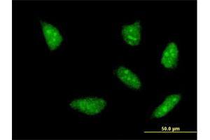 Immunofluorescence of monoclonal antibody to HOXA5 on HeLa cell. (HOXA5 antibody  (AA 171-270))