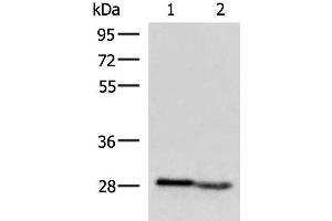 Western blot analysis of Human fetal intestines tissue and Human fetal liver tissue lysates using KLRB1 Polyclonal Antibody at dilution of 1:800 (CD161 antibody)