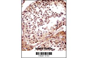 TNKS Antibody immunohistochemistry analysis in formalin fixed and paraffin embedded human testis tissue followed by peroxidase conjugation of the secondary antibody and DAB staining. (TNKS antibody  (N-Term))