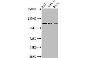 Western Blot Positive WB detected in: 293 whole cell lysate, Jurkat whole cell lysate, Hela whole cell lysate All lanes: NEDD4L antibody at 3 μg/mL Secondary Goat polyclonal to rabbit IgG at 1/50000 dilution Predicted band size: 112, 105, 101, 99, 111, 110, 97 kDa Observed band size: 112 kDa (NEDD4-2 antibody  (AA 289-494))