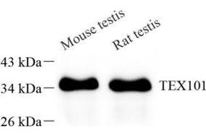 Western blot analysis of TEX101 (ABIN7075861) at dilution of 1: 1000 (TEX101 antibody)