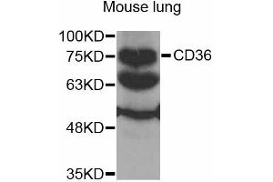 Western blot analysis of extracts of mouse lung, using CD36 antibody (ABIN2561720) at 1:1000 dilution. (CD36 antibody)