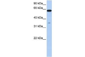 WB Suggested Anti-KPNA6 Antibody Titration: 0.