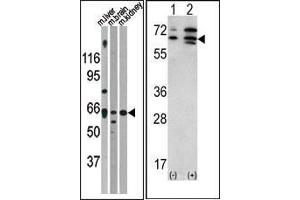 (LEFT)Western blot analysis of anti-ACVR2A Antibody (N-term) in mouse liver brain and kidney tissue lysates (35ug/lane). (ACVR2A antibody  (N-Term))