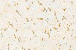 Immunohistochemistry analysis of paraffin-embedded mouse cerebellum using ADAMTS4 (ABIN7072947) at dilution of 1: 500 (ADAMTS4 antibody)