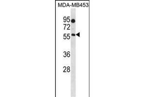 B4GALNT1 Antibody (Center) (ABIN1538263 and ABIN2849848) western blot analysis in MDA-M cell line lysates (35 μg/lane). (B4GALNT1 antibody  (AA 296-323))