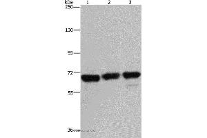 Western blot analysis of 293T, Jurkat and Hela cell, using PCK2 Polyclonal Antibody at dilution of 1:750 (PEPCK antibody)