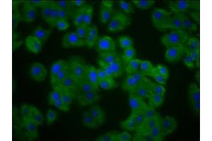 Immunofluorescence staining of HepG2 cells with ABIN7162591 at 1:133, counter-stained with DAPI. (Pannexin 3 antibody  (AA 135-215))