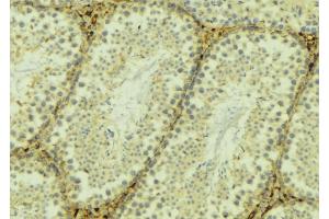 ABIN6268946 at 1/100 staining Mouse testis tissue by IHC-P. (TXNRD2 antibody  (C-Term))