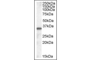 Image no. 1 for anti-Solute Carrier Family 10 (Sodium/bile Acid Cotransporter Family), Member 2 (SLC10A2) (C-Term) antibody (ABIN375244) (SLC10A2 antibody  (C-Term))