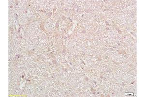 Formalin-fixed and paraffin embedded rat brain tissue with labeled Anti-CD38 Polyclonal Antibody, Unconjugated  at 1:200, followed by conjugation to the secondary antibody and DAB staining