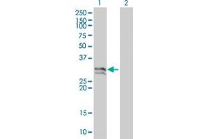 Western Blot analysis of NT5E expression in transfected 293T cell line by NT5E monoclonal antibody (M01), clone 4C4-2B5. (CD73 antibody  (AA 28-264))