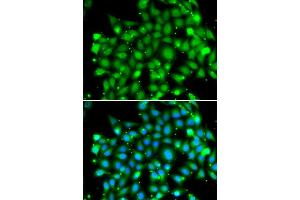 Immunofluorescence analysis of MCF-7 cells using SUFU antibody (ABIN6133029, ABIN6148692, ABIN6148694 and ABIN6217424). (SUFUH antibody  (AA 325-484))