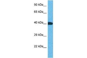 Host:  Rabbit  Target Name:  ZNF883  Sample Type:  Thyroid Tumor lysates  Antibody Dilution:  1. (ZNF883 antibody  (C-Term))
