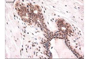 Image no. 5 for anti-Keratin 18 (KRT18) (AA 69-372) antibody (ABIN1491639)