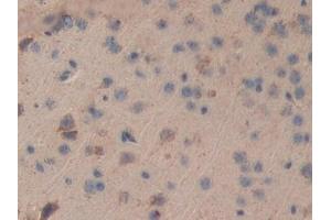 Detection of DLD in Mouse Cerebrum Tissue using Polyclonal Antibody to Dihydrolipoyl Dehydrogenase (DLD)