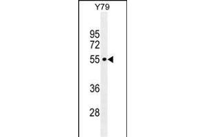CCDC97 Antibody (C-term) (ABIN655301 and ABIN2844887) western blot analysis in Y79 cell line lysates (35 μg/lane). (CCDC97 antibody  (C-Term))