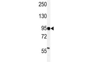 Western Blotting (WB) image for anti-Hypoxia Inducible Factor 1, alpha Subunit (Basic Helix-Loop-Helix Transcription Factor) (HIF1A) (AA 728-757) antibody (ABIN3031282)