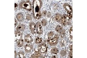 Immunohistochemical staining of human breast with MUCL1 polyclonal antibody  shows moderate cytoplasmic and extracellular positivity in glandular cells at 1:20-1:50 dilution. (SBEM antibody)