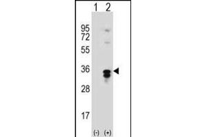 Western blot analysis of T1 (arrow) using rabbit polyclonal T1 Antibody  (ABIN389117 and ABIN2839303). (PPT1 antibody  (C-Term))