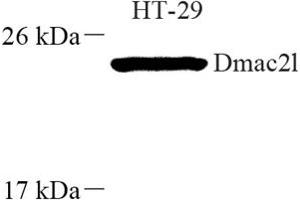 Western blot analysis of Dmac2l (ABIN7073751) at dilution of 1: 250 (Distal Membrane Arm Assembly Complex 2 L Homeolog (DMAC2.L) antibody)